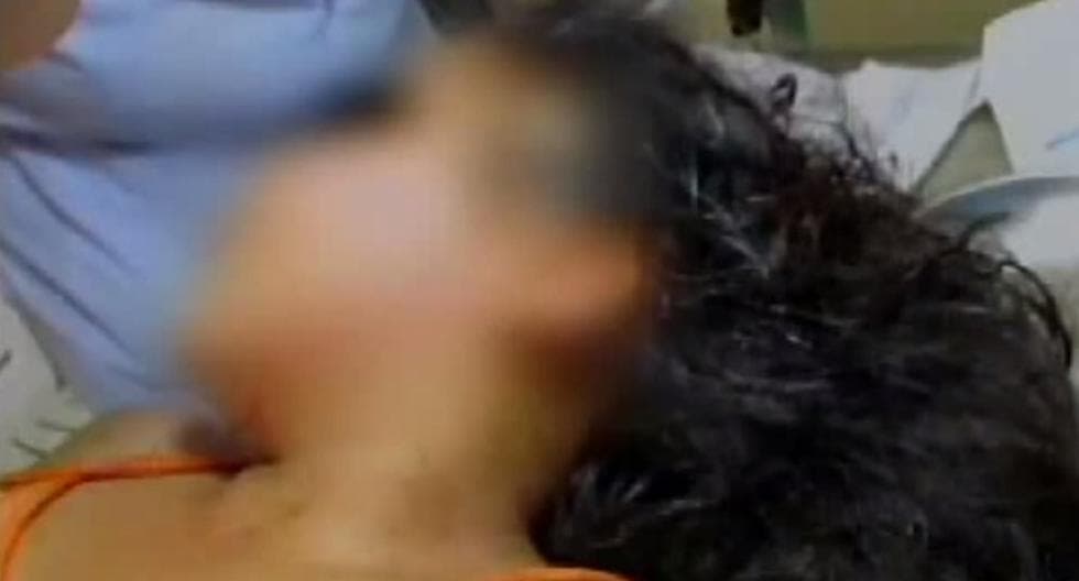 Ladrón cortó rostro de la niña que lo reconoció