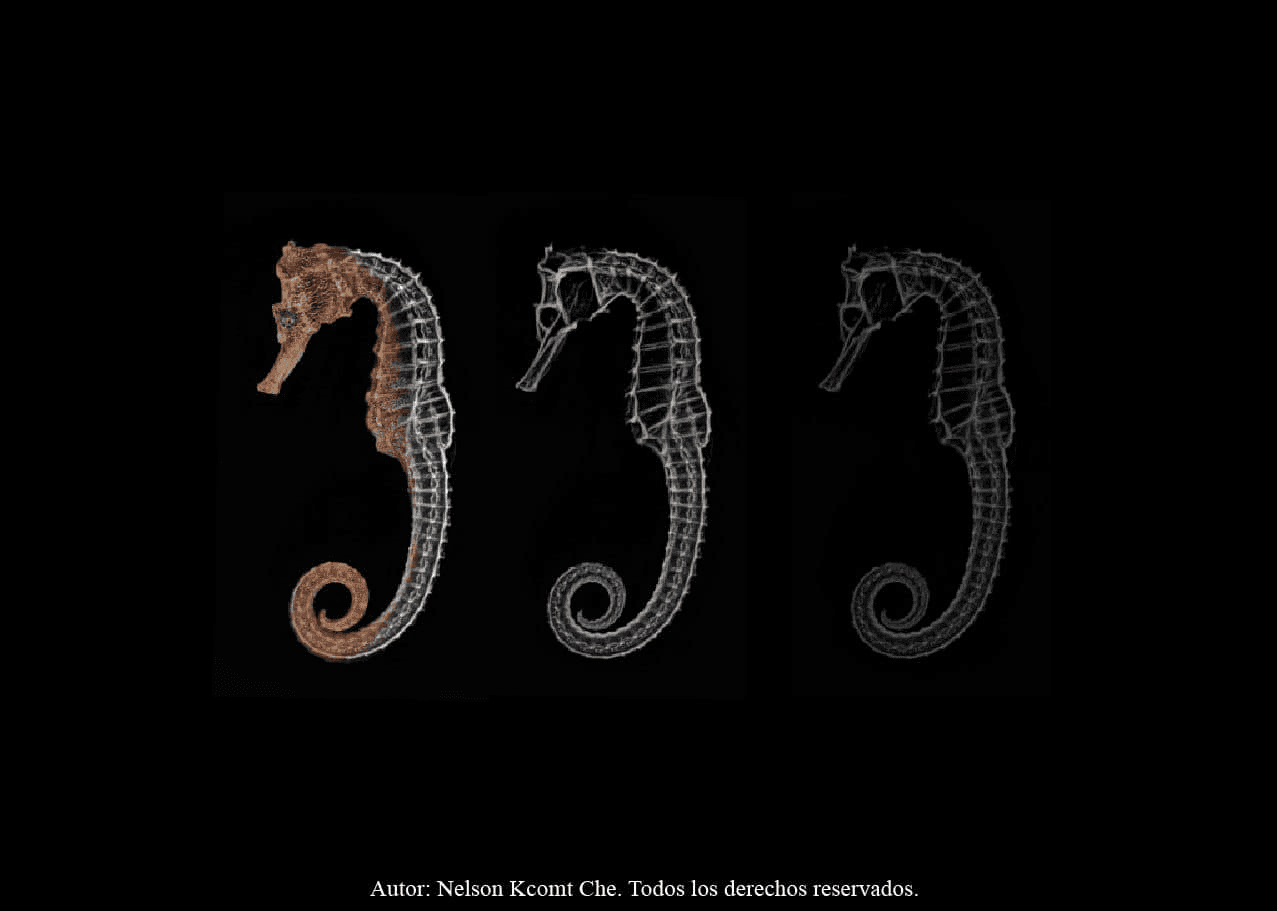 Radiografías como Arte: La Exposición de Nelson Kcomt