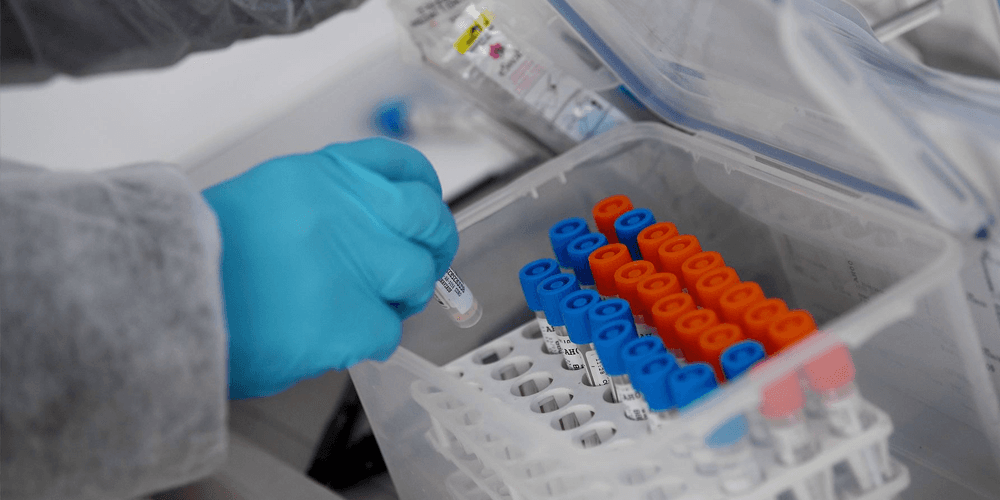 La Libertad registra siete fallecidos y 226 nuevos casos de covid-19 en las últimas 24 horas