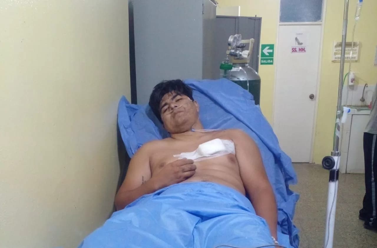 Confrontación en Ciudad de Dios: Un Presunto Ladrón Herido tras Enfrentamiento con la Policía