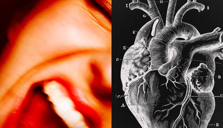 La Ira y el Corazón: Cómo un Estallido de Ira Puede Incrementar el Riesgo de Infarto