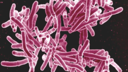 La tuberculosis: el peligro inminente de una epidemia