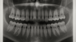 Medicina Japonesa para Regenerar un Tercer Conjunto de Dientes