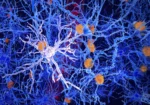 Descubren células cerebrales que podrían detener Alzheimer